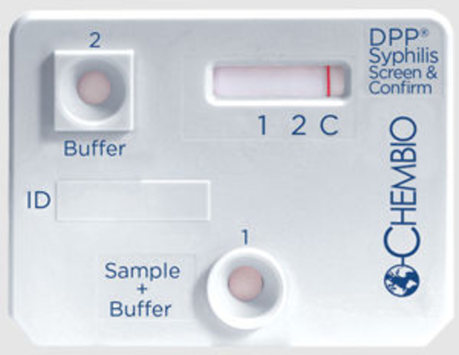 Syphilis Rapid Test Kits