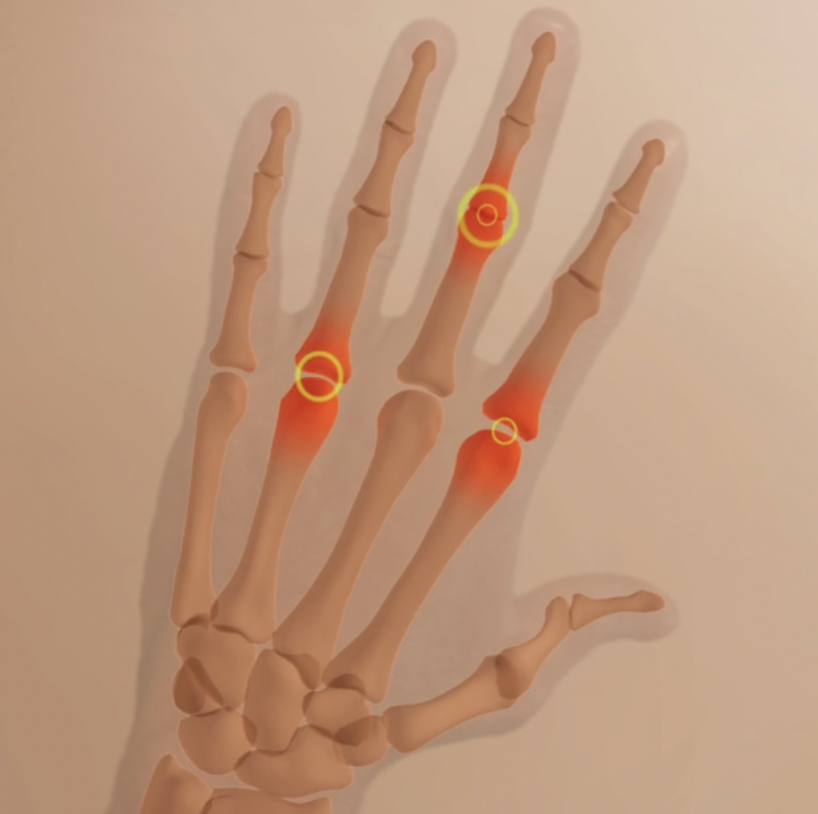 arthritis Products manufacturers